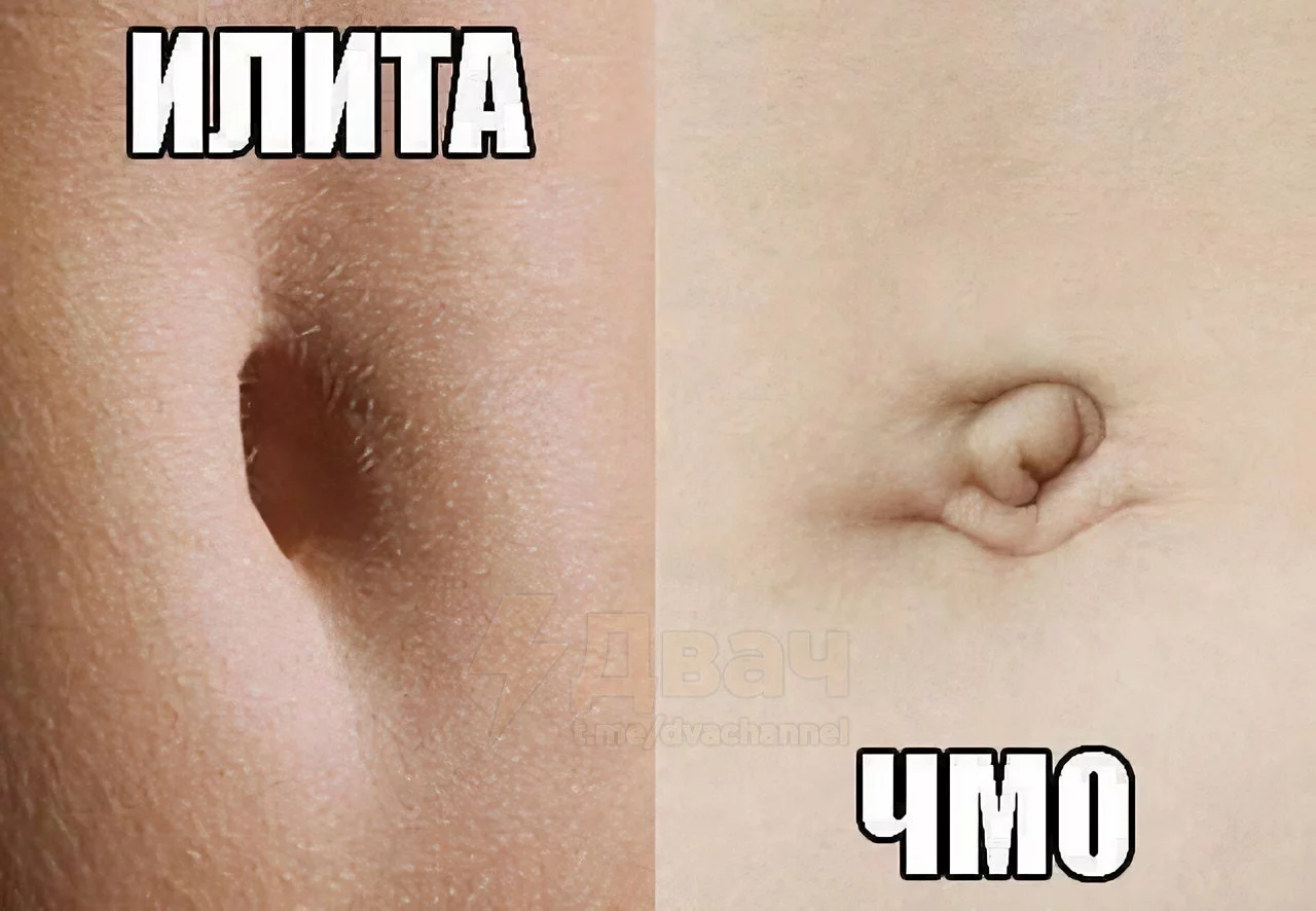 Илита